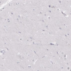 Immunohistochemical staining of human cerebral cortex shows low expression as expected.