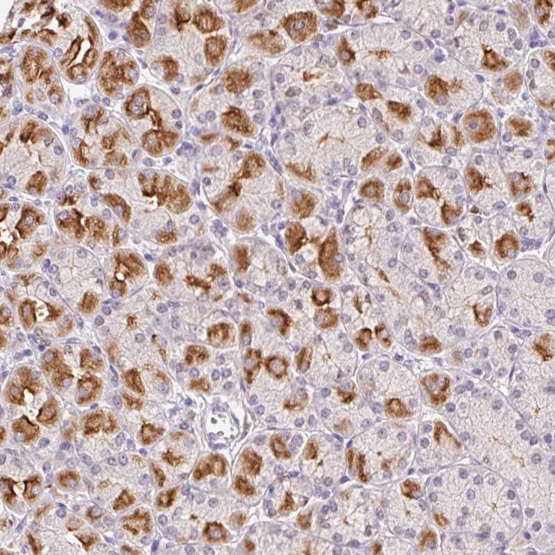 Anti-L3MBTL4 Antibody