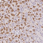 Anti-L3MBTL4 Antibody