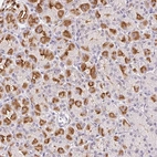 Anti-L3MBTL4 Antibody
