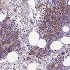 Immunohistochemical staining of human bone marrow shows high expression.