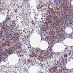 Immunohistochemical staining of human bone marrow shows high expression.
