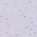 Immunohistochemical staining of human cerebral cortex shows low expression as expected.