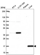 Western blot analysis in human cell line RT-4, human cell line U-251 MG, human plasma and human liver tissue.