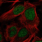 Immunofluorescent staining of human cell line U-2 OS shows localization to nucleoplasm.