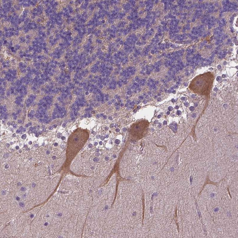 Anti-ZNF337 Antibody