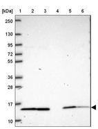 Lane 1: Marker [kDa] 250, 130, 95, 72, 55, 36, 28, 17, 10_br/_Lane 2: Human cell line RT-4_br/_Lane 3: Human cell line U-251 MG_br/_Lane 4: Human plasma_br/_Lane 5: Human Liver tissue_br/_Lane 6: Human Tonsil tissue