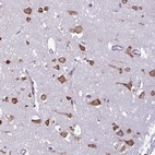 Anti-RPS16 Antibody