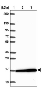 Lane 1: Marker [kDa] 250, 130, 95, 72, 55, 36, 28, 17, 10_br/_Lane 2: Human cell line RT-4_br/_Lane 3: Human cell line U-251MG sp