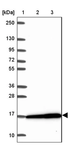 Lane 1: Marker [kDa] 250, 130, 95, 72, 55, 36, 28, 17, 10_br/_Lane 2: Human cell line RT-4_br/_Lane 3: Human cell line U-251MG sp