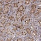 Immunohistochemical staining of human kidney shows strong membranous positivity in cells in tubules.