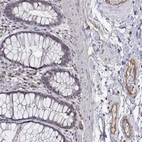 Immunohistochemical staining of human rectum shows moderate membranous positivity in endothelial cells.