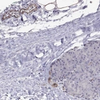 Immunohistochemical staining of human pancreas shows strong membranous positivity in endothelial cells.