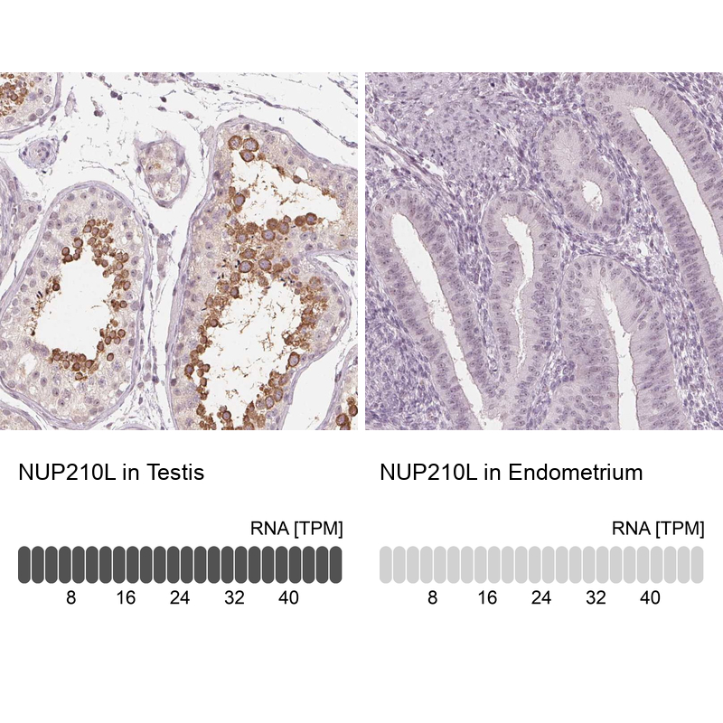 Anti-NUP210L Antibody