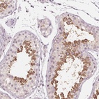 Immunohistochemical staining of human testis shows high expression.