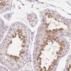 Immunohistochemical staining of human testis shows high expression.