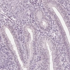 Immunohistochemical staining of human endometrium shows low expression as expected.