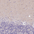 Anti-SSTR4 Antibody