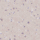 Anti-SSTR4 Antibody