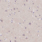 Immunohistochemical staining of human cerebral cortex shows weak positivity in neuropil.