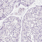 Immunohistochemical staining of human testis shows no positivity in cells in seminiferous ducts as expected.