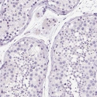 Immunohistochemical staining of human testis shows no positivity in cells in seminiferous ducts as expected.