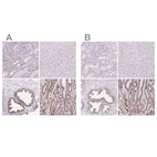 Immunohistochemical staining of human kidney, liver, prostate and stomach using Anti-GALNT7 antibody HPA064243 (A) shows similar protein distribution across tissues to independent antibody HPA065317 (B).