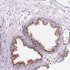 Immunohistochemical staining of human prostate shows strong positivity in glandular cells of Golgi apparatus.