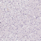 Immunohistochemical staining of human liver shows no positivity in hepatocytes as expected.