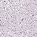 Immunohistochemical staining of human liver shows no positivity in hepatocytes as expected.