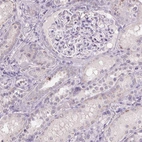Immunohistochemical staining of human kidney shows very weak positivity in cells in tubules as expected.