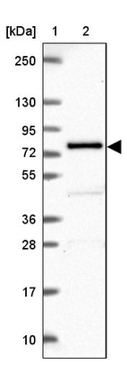 Anti-GALNT7 Antibody
