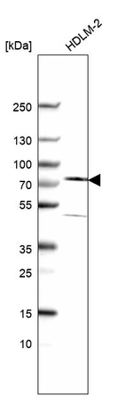 Western blot analysis in human cell line HDLM-2.