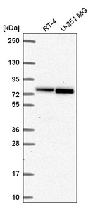 Anti-RECQL Antibody