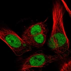 Immunofluorescent staining of human cell line U-251 MG shows localization to nucleoplasm.