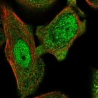 Immunofluorescent staining of human cell line PC-3 shows localization to nucleoplasm & cytosol.