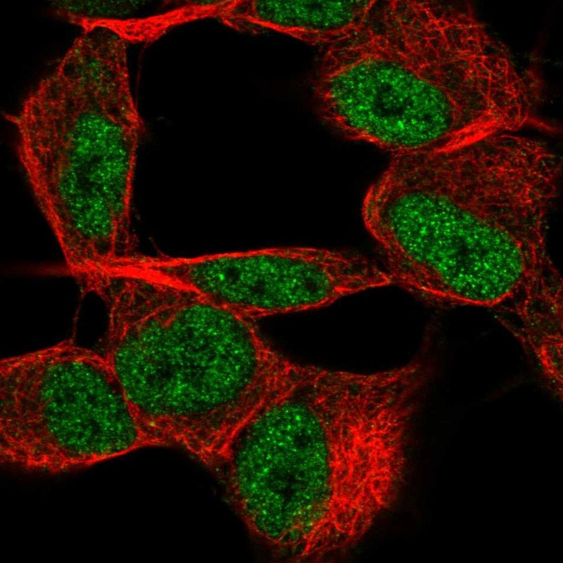 Anti-TSTD2 Antibody