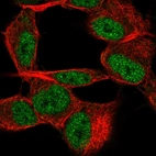 Anti-TSTD2 Antibody