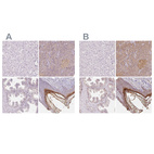 Immunohistochemical staining of human liver, pancreas, prostate and skin using Anti-BLMH antibody HPA064307 (A) shows similar protein distribution across tissues to independent antibody HPA039548 (B).