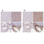 Immunohistochemical staining of human liver, pancreas, prostate and skin using Anti-BLMH antibody HPA064307 (A) shows similar protein distribution across tissues to independent antibody HPA039548 (B).