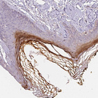 Immunohistochemical staining of human skin shows strong cytoplasmic positivity in epidermal cells in corneal layer.