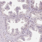 Immunohistochemical staining of human prostate shows no cytoplasmic positivity in glandular cells as expected.
