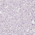 Immunohistochemical staining of human liver shows no cytoplasmic positivity in hepatocytes as expected.