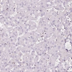 Immunohistochemical staining of human liver shows no cytoplasmic positivity in hepatocytes as expected.