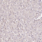 Anti-CENPF Antibody