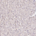 Immunohistochemical staining of human liver shows low expression as expected.