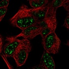 Immunofluorescent staining of human cell line SH-SY5Y shows localization to nuclear speckles.
