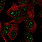 Immunofluorescent staining of human cell line SH-SY5Y shows localization to nuclear speckles.
