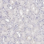 Immunohistochemical staining of human kidney shows no positivity in cells in tubules as expected.