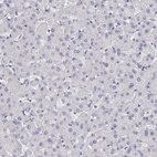 Anti-LY6D Antibody